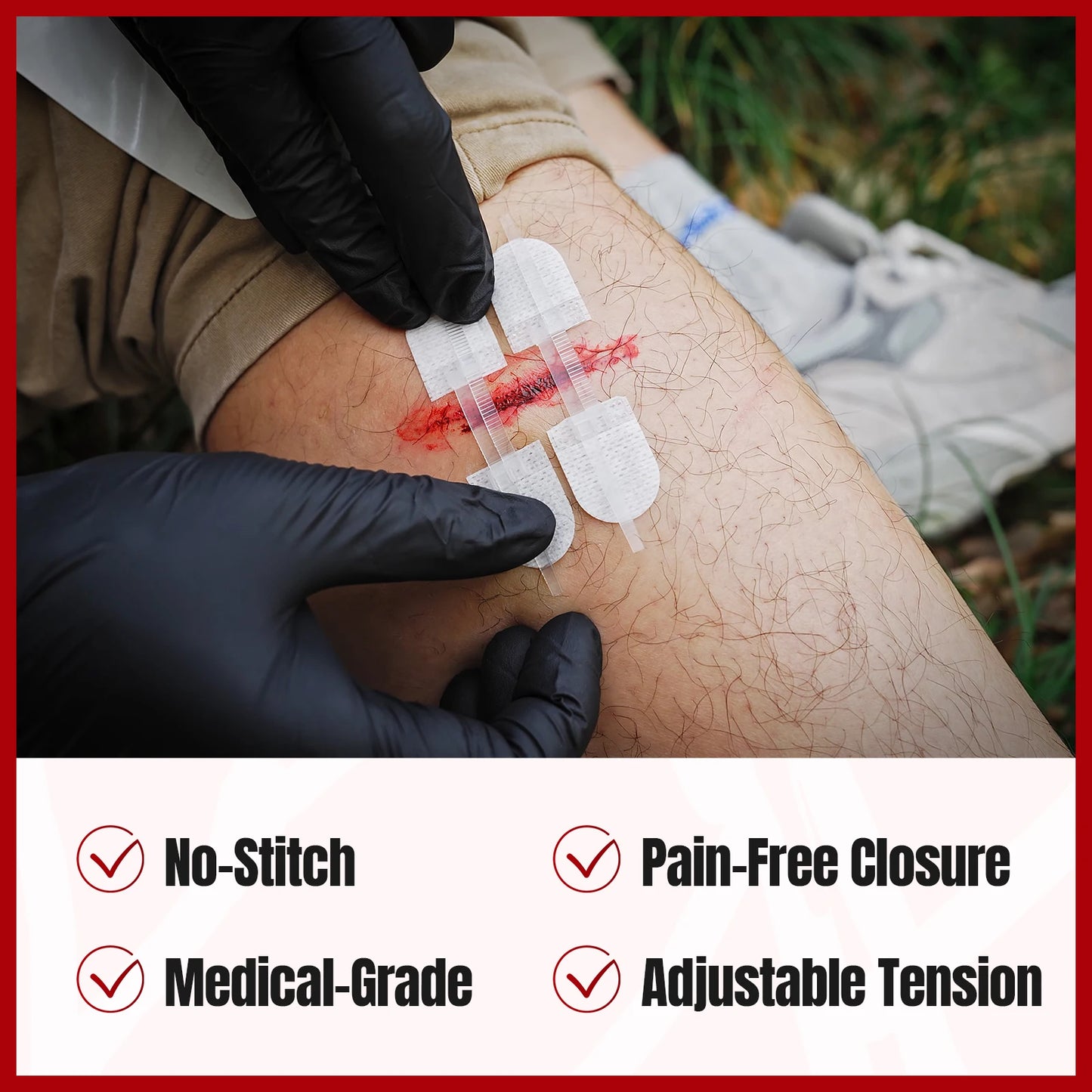 RHINO RESCUE Zip Stitch 6pcs with Wound Dresssings, Wound Closure Strips, Zipstitch Laceration Closure Kit for Cut Care Band-aid